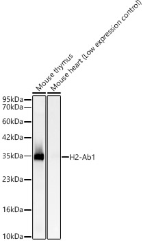 Western blot analysis of various lysates using H2-Ab1 Rabbit mAb at 1:4000 dilution incubated overnight at 4℃.|Secondary antibody: HRP-conjugated Goat anti-Rabbit IgG (H+L) at 1:10000 dilution.|Lysates/proteins: 25μg per lane.|Blocking buffer: 3% nonfat dry milk in TBST.|Detection: ECL Basic Kit.|Exposure time: 15s.