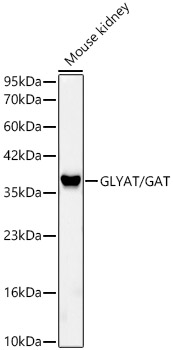 Western blot analysis of lysates from Mouse kidney, using GLYAT/GAT Rabbit mAb at 1:2000 dilution.|Secondary antibody: HRP-conjugated Goat anti-Rabbit IgG (H+L) at 1:10000 dilution.|Lysates/proteins: 25μg per lane.|Blocking buffer: 3% nonfat dry milk in TBST.|Detection: ECL Basic Kit.|Exposure time: 45s.