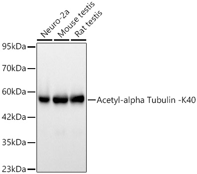 Western blot analysis of various lysates using Acetyl-alpha Tubulin -K40 Rabbit mAb at 1:1000 dilution incubated overnight at 4℃.|Secondary antibody: HRP-conjugated Goat anti-Rabbit IgG (H+L) at 1:10000 dilution.|Lysates/proteins: 25 μg per lane.|Blocking buffer: 3% nonfat dry milk in TBST.|Detection: ECL Basic Kit.|Exposure time: 10s.