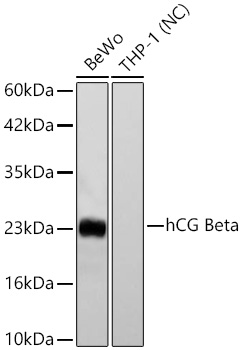 Western blot analysis of various lysates using hCG Beta Rabbit mAb at 1:1000 dilution incubated overnight at 4℃.|Secondary antibody: HRP-conjugated Goat anti-Rabbit IgG (H+L) at 1:10000 dilution.|Lysates/proteins: 25 μg per lane.|Blocking buffer: 3% nonfat dry milk in TBST.|Detection: ECL Basic Kit.|Negative control (NC): THP-1|Exposure time: 45s.