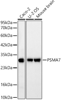 Western blot analysis of various lysates using [KD Validated] PSMA7 Rabbit mAb at 1:2000 dilution.|Secondary antibody: HRP-conjugated Goat anti-Rabbit IgG (H+L) at 1:10000 dilution.|Lysates/proteins: 25μg per lane.|Blocking buffer: 3% nonfat dry milk in TBST.|Detection: ECL Basic Kit.|Exposure time: 20s.