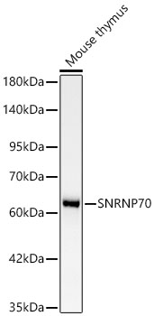 Western blot analysis of lysates from Mouse thymus using [KD Validated] SNRNP70 Rabbit mAb at 1:1000 dilution.|Secondary antibody: HRP-conjugated Goat anti-Rabbit IgG (H+L) at 1:10000 dilution.|Lysates/proteins: 25 μg per lane.|Blocking buffer: 3% nonfat dry milk in TBST.|Detection: ECL Basic Kit.|Exposure time: 90s.