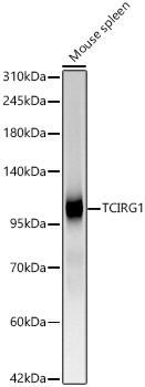 Western blot analysis of lysates from Mouse spleen, using TCIRG1 Rabbit mAb at 1:4000 dilution.|Secondary antibody: HRP-conjugated Goat anti-Rabbit IgG (H+L) at 1:10000 dilution.|Lysates/proteins: 25μg per lane.|Blocking buffer: 3% nonfat dry milk in TBST.|Detection: ECL Basic Kit.|Exposure time: 45s.