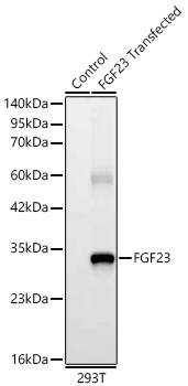 Western blot analysis of lysates from wild type (WT) and 293T cells transfected with FGF23 using FGF23 Rabbit mAb at 1:6000 dilution.|Secondary antibody: HRP-conjugated Goat anti-Rabbit IgG (H+L) at 1:10000 dilution.|Lysates/proteins: 25μg per lane.|Blocking buffer: 3% nonfat dry milk in TBST.|Detection: ECL Basic Kit.|Exposure time: 5s.