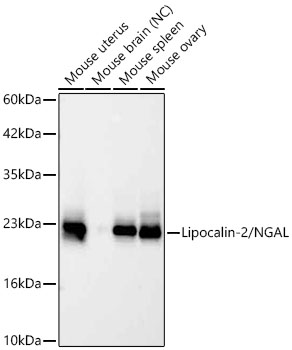 Western blot analysis of various lysates using Lipocalin-2/NGAL Rabbit mAb at 1:1000 dilution.|Secondary antibody: HRP-conjugated Goat anti-Rabbit IgG (H+L) at 1:10000 dilution.|Lysates/proteins: 25 μg per lane.|Blocking buffer: 3% nonfat dry milk in TBST.|Detection: ECL Basic Kit.|Negative control (NC): Mouse brain.|Exposure time: 45s.