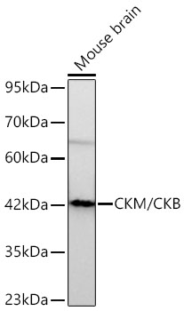 Western blot analysis of lysates from Mouse brain using CKM/CKB Rabbit mAb at 1:1000 dilution incubated overnight at 4℃.|Secondary antibody: HRP-conjugated Goat anti-Rabbit IgG (H+L) at 1:10000 dilution.|Lysates/proteins: 25 μg per lane.|Blocking buffer: 3% nonfat dry milk in TBST.|Detection: ECL Basic Kit.|Exposure time: 180s.
