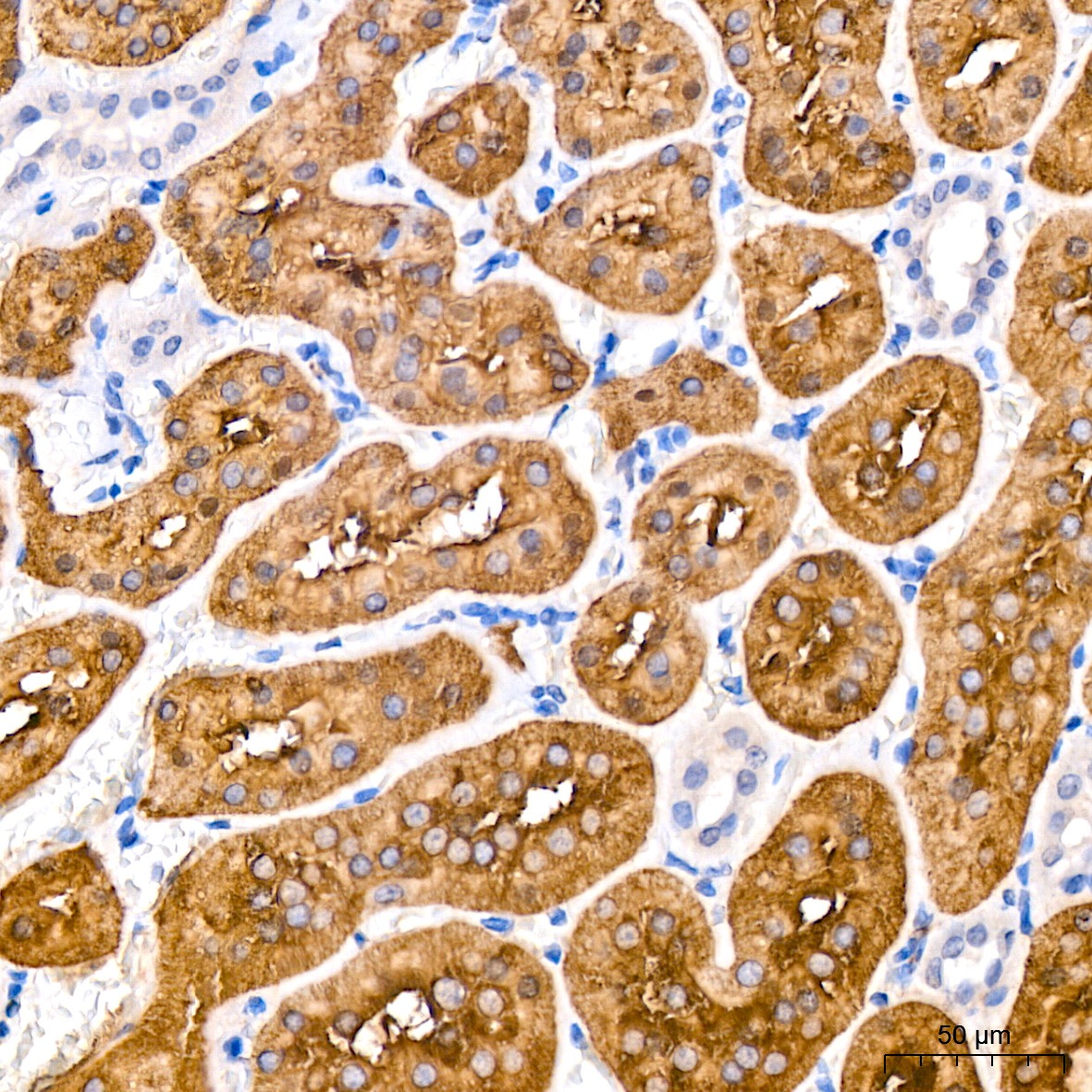Immunohistochemistry analysis of paraffin-embedded Rat kidney tissue using TPH-1 Rabbit mAb at a dilution of  1:200 (40x lens). High pressure antigen retrieval was performed with 0.01 M citrate buffer (pH 6.0) prior to IHC staining.