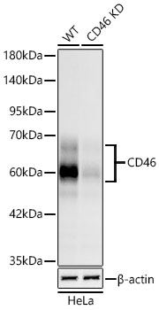Western blot analysis of lysates from wild type (WT) and CD46 knockdown (KD) HeLa cells using [KD Validated] CD46 Rabbit mAb at 1:1000 dilution incubated overnight at 4°C.|Secondary antibody: HRP-conjugated Goat anti-Rabbit IgG (H+L) at 1:10000 dilution. |Lysates/proteins: 25 μg per lane.|Blocking buffer: 3% nonfat dry milk in TBST.|Detection: ECL Basic Kit.|Exposure time: 90s.