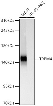 Western blot analysis of various lysates using TRPM4 Rabbit mAb at 1:1000 dilution.|Secondary antibody: HRP-conjugated Goat anti-Rabbit IgG (H+L) at 1:10000 dilution.|Lysates/proteins: 25 μg per lane.|Blocking buffer: 3% nonfat dry milk in TBST.|Detection: ECL Basic Kit.|Negative control (NC): HL-60.|Exposure time: 45s.
