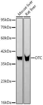 Western blot analysis of various lysates using OTC Rabbit mAb at 1:3000 dilution.|Secondary antibody: HRP-conjugated Goat anti-Rabbit IgG (H+L) at 1:10000 dilution.|Lysates/proteins: 25μg per lane.|Blocking buffer: 3% nonfat dry milk in TBST.|Detection: ECL Basic Kit.|Exposure time: 30s.