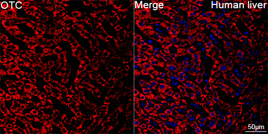 Confocal imaging of paraffin-embedded Human liver tissue using OTC Rabbit mAb followed by a further incubation with Cy3 Goat Anti-Rabbit IgG (H+L) (Red). DAPI was used for nuclear staining (Blue). High pressure antigen retrieval performed with 0.01M Citrate Buffer (pH 6.0) prior to IF staining. Objective: 40x.
