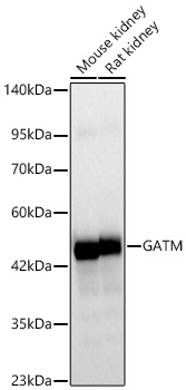 Western blot analysis of various lysates using GATM Rabbit mAb at 1:5500 dilution.| Secondary antibody: HRP-conjugated Goat anti-Rabbit IgG (H+L) at 1:10000 dilution.| Lysates / proteins: 25 μg per lane.| Blocking buffer: 3 % nonfat dry milk in TBST.| Detection: ECL Basic Kit.| Exposure time: 10s.