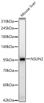 Western blot analysis of lysates from Mouse liver using NSUN2 Rabbit mAb at 1:1000 dilution dilution incubated overnight at 4℃.|Secondary antibody: HRP-conjugated Goat anti-Rabbit IgG (H+L) at 1:10000.|Lysates/proteins: 25 μg per lane.|Blocking buffer: 3% nonfat dry milk in TBST.|Detection: ECL Basic Kit.|Exposure time:45 s.