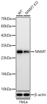Western blot analysis of lysates from wild type (WT) and NNMT knockdown (KD) HeLa cells using [KD Validated] NNMT Rabbit mAb at 1:3000 dilution. |Secondary antibody: HRP-conjugated Goat anti-Rabbit IgG (H+L)  at 1:10000 dilution.Lysates/proteins: 25 μg per lane.|Blocking buffer: 3% nonfat dry milk in TBST.|Detection: ECL Basic Kit.|Exposure time: 30s.