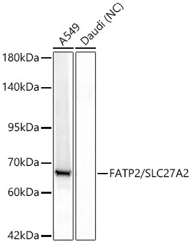 Western blot analysis of lysates from A549 cells using FATP2/SLC27A2 Rabbit mAb at 1:1000 dilution.|Secondary antibody: HRP-conjugated Goat anti-Rabbit IgG (H+L) at 1:10000 dilution.|Lysates/proteins: 25 μg per lane.|Blocking buffer: 3% nonfat dry milk in TBST.|Detection: ECL Basic Kit.|Negative control (NC): Daudi|Exposure time: 10s.