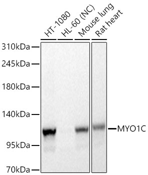 Western blot analysis of various lysates using MYO1C Rabbit mAb at 1:10000 dilution.|Secondary antibody: HRP-conjugated Goat anti-Rabbit IgG (H+L) at 1:10000 dilution.|Lysates/proteins: 25 μg per lane.|Blocking buffer: 3% nonfat dry milk in TBST.|Detection: ECL Basic Kit.|Negative control (NC): HL-60.|Exposure time: 1s.