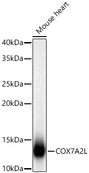 Western blot analysis of lysates from Mouse heart using [KD Validated] COX7A2L Rabbit mAb at 1:1000 dilution incubated overnight at 4℃.|Secondary antibody: HRP-conjugated Goat anti-Rabbit IgG (H+L) at 1:10000 dilution.|Lysates/proteins: 25 μg per lane.|Blocking buffer: 3% nonfat dry milk in TBST.|Detection: ECL Basic Kit.|Exposure time: 5s.