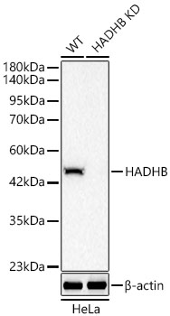 Western blot analysis of lysates from wild type (WT) and HADHB knockdown (KD) HeLa cells using [KD Validated] HADHB Rabbit mAb at 1:5000 dilution. |Secondary antibody: HRP-conjugated Goat anti-Rabbit IgG (H+L)  at 1:10000 dilution.|Lysates/proteins: 25 μg per lane.|Blocking buffer: 3% nonfat dry milk in TBST.|Detection: ECL Basic Kit.|Exposure time: 20s.