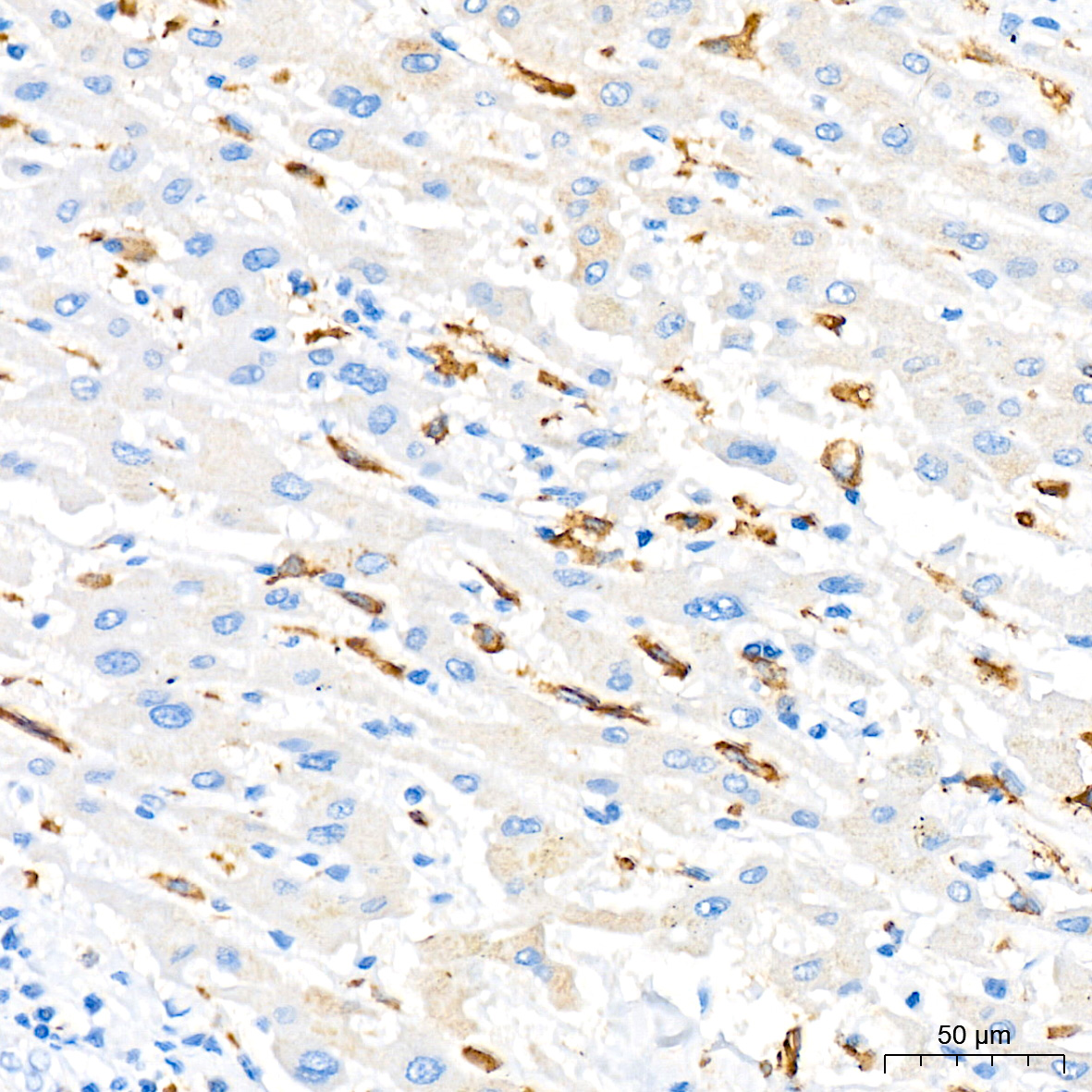 Immunohistochemistry analysis of paraffin-embedded Human liver tissue using CD204 Rabbit mAb at a dilution of 1:200 (40x lens). High pressure antigen retrieval performed with 0.01M Citrate buffer (pH 6.0) prior to IHC staining.