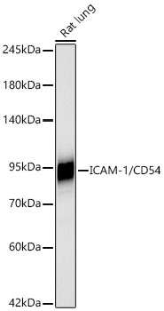 Western blot analysis of lysates from Rat lung using ICAM-1/CD54 Rabbit mAb at 1:5000 dilution incubated overnight at 4℃.|Secondary antibody: HRP-conjugated Goat anti-Rabbit IgG (H+L) at 1:10000 dilution.|Lysates/proteins: 25 μg per lane.|Blocking buffer: 3% nonfat dry milk in TBST.|Detection: ECL Basic Kit.|Exposure time: 30s.