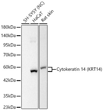 Western blot analysis of various lysates using Cytokeratin 14 (KRT14) Rabbit mAb at 1:3000 dilution.|Secondary antibody: HRP-conjugated Goat anti-Rabbit IgG (H+L) at 1:10000 dilution.|Lysates/proteins: 25 μg per lane.|Blocking buffer: 3% nonfat dry milk in TBST.|Detection: ECL Basic Kit.|Negative control (NC): SH-SY5Y.|Exposure time: 1s.