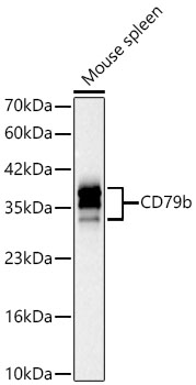 Western blot analysis of lysates from Mouse spleen using CD79b Rabbit mAb at 1:1000 dilution.|Secondary antibody: HRP-conjugated Goat anti-Rabbit IgG (H+L) at 1:10000 dilution.|Lysates/proteins: 25 μg per lane.|Blocking buffer: 3% nonfat dry milk in TBST.|Detection: ECL Basic Kit.|Exposure time: 30s.