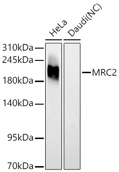 Western blot analysis of various lysates using MRC2 Rabbit mAb at 1:1000 dilution incubated overnight at 4℃.|Secondary antibody: HRP-conjugated Goat anti-Rabbit IgG (H+L) at 1:10000 dilution.|Lysates/proteins: 25 μg per lane.|Blocking buffer: 3% nonfat dry milk in TBST.|Detection: ECL Basic Kit.|Negative control (NC): Daudi|Exposure time: 60s.