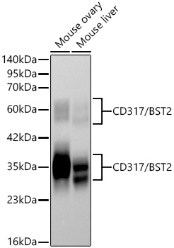 Western blot analysis of various lysates using CD317/BST2 Rabbit mAb at 1:3000 dilution incubated overnight at 4℃.|Secondary antibody: HRP-conjugated Goat anti-Rabbit IgG (H+L) at 1:10000 dilution.|Lysates/proteins: 25 μg per lane.|Blocking buffer: 3% nonfat dry milk in TBST.|Detection: ECL Basic Kit.|Exposure time: 90s.