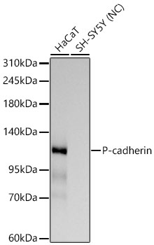 Western blot analysis of various lysates using P-cadherin Rabbit mAb at 1:3000 dilution.|Secondary antibody: HRP-conjugated Goat anti-Rabbit IgG (H+L) at 1:10000 dilution.|Lysates/proteins: 25 μg per lane.|Blocking buffer: 3% nonfat dry milk in TBST.|Detection: ECL Basic Kit.|Negative control (NC): SH-SY5Y.|Exposure time: 30s.