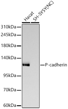 Western blot analysis of various lysates using P-cadherin Rabbit mAb at 1:3000 dilution incubated at room temperature for 1.5 hours.|Secondary antibody: HRP-conjugated Goat anti-Rabbit IgG (H+L) at 1:10000 dilution.|Lysates/proteins: 25 μg per lane.|Blocking buffer: 3% nonfat dry milk in TBST.|Detection: ECL Basic Kit.|Negative control (NC): SH-SY5Y|Exposure time: 45s.
