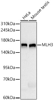 Western blot analysis of various lysates using MLH3 Rabbit mAb at 1:1000 dilution.| Secondary antibody: HRP-conjugated Goat anti-Rabbit IgG (H+L) at 1:10000 dilution.| Lysates/proteins: 25 μg per lane.| Blocking buffer: 3 % nonfat dry milk in TBST.| Detection: ECL Basic Kit.| Exposure time: 10s.