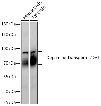 Western blot analysis of various lysates using Dopamine Transporter/DAT Rabbit mAb at 1:1000 dilution incubated overnight at 4℃.|Secondary antibody: HRP-conjugated Goat anti-Rabbit IgG (H+L) at 1:10000 dilution.|Lysates/proteins: 30 μg per lane.|Blocking buffer: 3% nonfat dry milk in TBST.|Detection: ECL Basic Kit.|Exposure time: 45s.