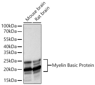 Western blot analysis of various lysates using Myelin Basic Protein Rabbit mAb at 1:36000 dilution incubated overnight at 4℃.|Secondary antibody: HRP-conjugated Goat anti-Rabbit IgG (H+L) at 1:10000 dilution.|Lysates/proteins: 25 μg per lane.|Blocking buffer: 3% nonfat dry milk in TBST.|Detection: ECL Basic Kit.|Exposure time: 1s.