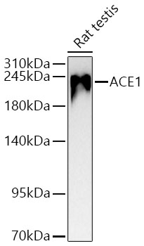 Western blot analysis of lysates from Rat testis using ACE1 Rabbit mAb at 1:1000 dilution incubated overnight at 4℃.|Secondary antibody: HRP-conjugated Goat anti-Rabbit IgG (H+L) at 1:10000 dilution.|Lysates/proteins: 25 μg per lane.|Blocking buffer: 3% nonfat dry milk in TBST.|Detection: ECL Basic Kit.|Exposure time: 90 s.