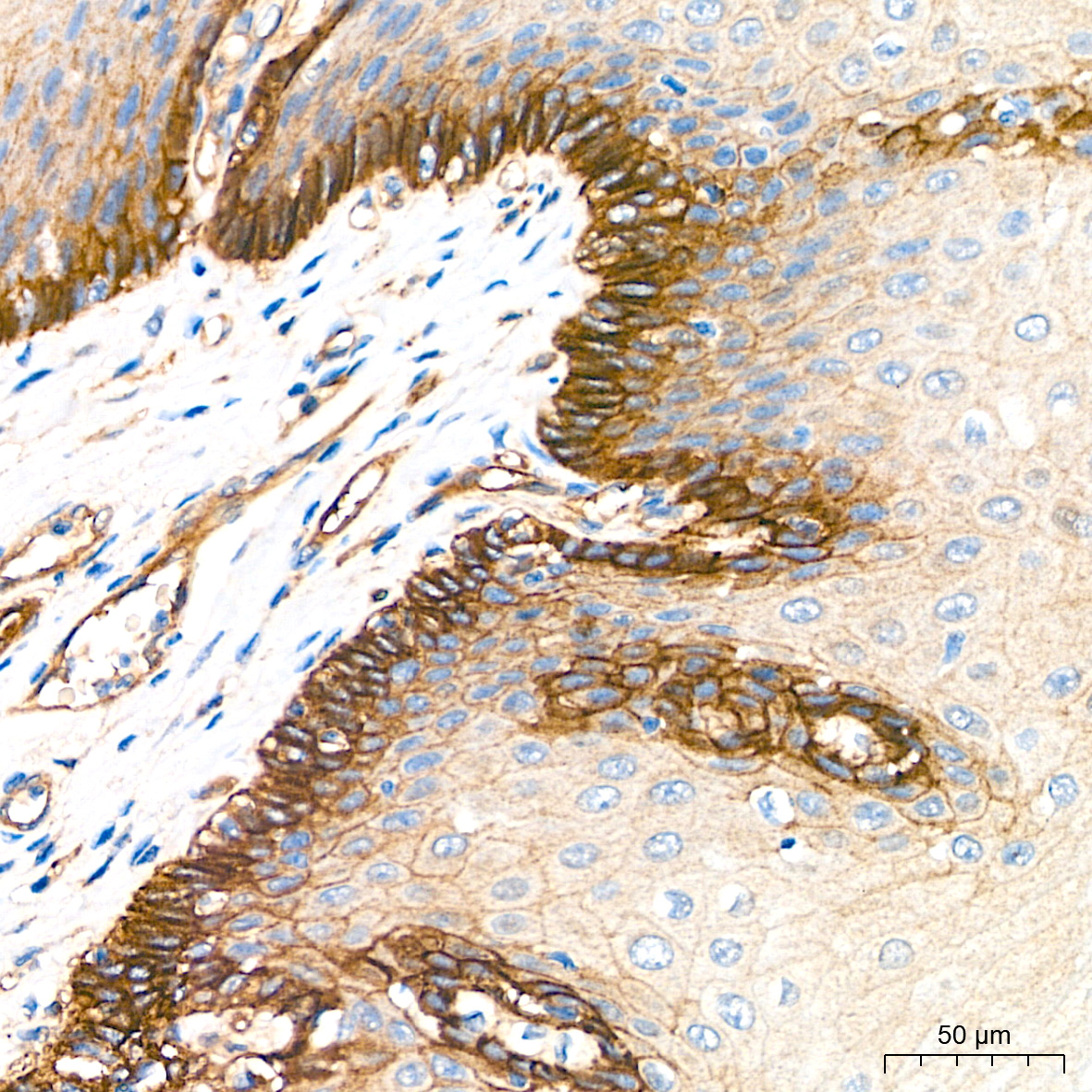 Immunohistochemistry analysis of paraffin-embedded Human esophagus tissue using Integrin alpha 3/CD49c Rabbit mAb at a dilution of 1:200 (40x lens). High pressure antigen retrieval performed with 0.01M Citrate Buffer(pH 6.0) prior to IHC staining.