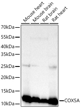 Western blot analysis of various lysates using [KD Validated] COX5A Rabbit mAb at 1:20000 dilution incubated overnight at 4℃.|Secondary antibody: HRP-conjugated Goat anti-Rabbit IgG (H+L) at 1:10000 dilution.|Lysates/proteins: 25 μg per lane.|Blocking buffer: 3% nonfat dry milk in TBST.|Detection: ECL Basic Kit.|Exposure time: 10s.