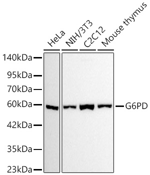 Western blot analysis of various lysates using G6PD Rabbit mAb at 1:1000 dilution incubated overnight at 4℃.|Secondary antibody: HRP-conjugated Goat anti-Rabbit IgG (H+L) at 1:10000 dilution.|Lysates/proteins: 25 μg per lane.|Blocking buffer: 3% nonfat dry milk in TBST.|Detection: ECL Basic Kit.|Exposure time: 10s.