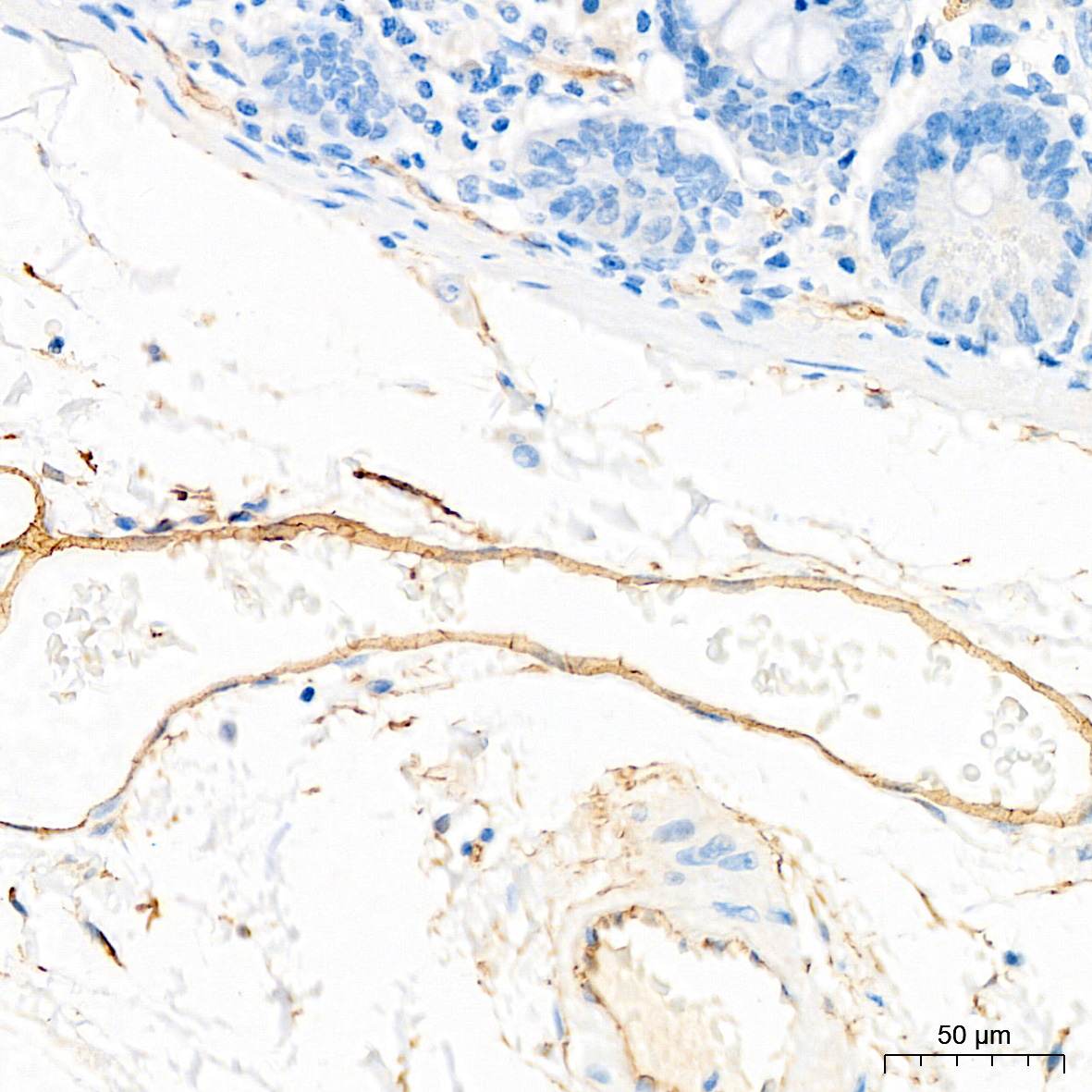 Immunohistochemistry analysis of paraffin-embedded Human colon tissue using CD34 Rabbit mAb at a dilution of 1:300 (40x lens). High pressure antigen retrieval performed with 0.01M Tris-EDTA Buffer (pH 9.0) prior to IHC staining.