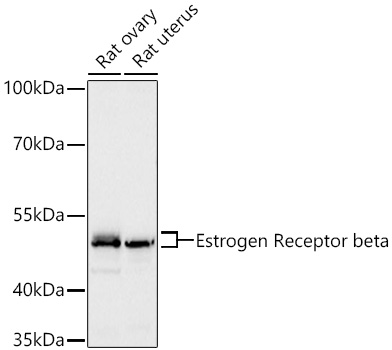 Western blot analysis of various lysates using Estrogen Receptor beta Rabbit mAb at 1:2000 dilution incubated overnight at 4℃.|Secondary antibody: HRP-conjugated Goat anti-Rabbit IgG (H+L) at 1:10000 dilution.|Lysates/proteins: 25 μg per lane.|Blocking buffer: 3% nonfat dry milk in TBST.|Detection: ECL Basic Kit.|Exposure time: 60s.