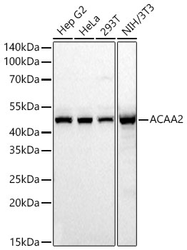 Western blot analysis of various lysates using ACAA2 Rabbit mAb at 1:1000 dilution incubated overnight at 4℃.|Secondary antibody: HRP-conjugated Goat anti-Rabbit IgG (H+L) at 1:10000 dilution.|Lysates/proteins: 25 μg per lane.|Blocking buffer: 3% nonfat dry milk in TBST.|Detection: ECL Basic Kit.|Exposure time: 30s.