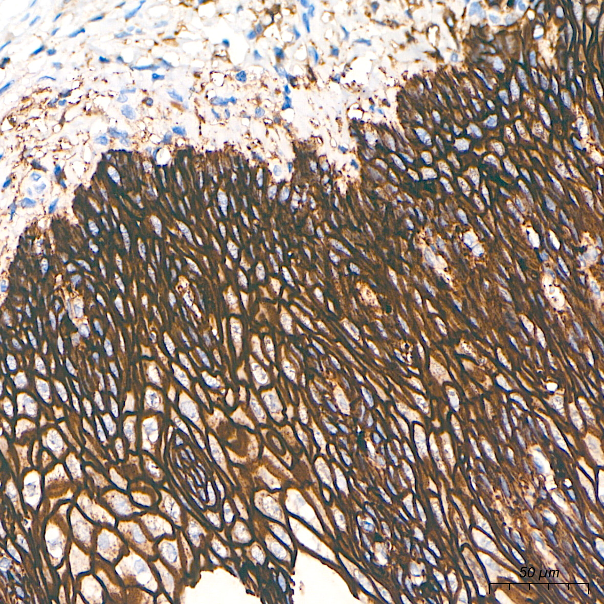 Immunohistochemistry analysis of paraffin-embedded Human esophagus tissue using CD138 Rabbit mAb at a dilution of 1:500 (40x lens). High pressure antigen retrieval performed with 0.01M Tris-EDTA Buffer (pH 9.0) prior to IHC staining.