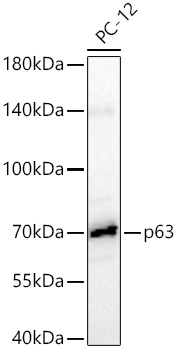 Western blot analysis of lysates from PC-12 cells using p63 Rabbit mAb at 1:1000 dilution incubated overnight at 4℃.|Secondary antibody: HRP-conjugated Goat anti-Rabbit IgG (H+L) at 1:10000 dilution.|Lysates/proteins: 25 μg per lane.|Blocking buffer: 3% nonfat dry milk in TBST.|Detection: ECL Basic Kit.|Exposure time: 30s.