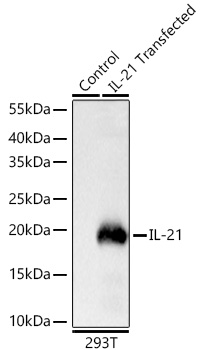 Western blot analysis of lysates from wild type (WT) and 293T cells transfected with IL-21 using IL-21 Rabbit mAb at 1:2000 dilution incubated overnight at 4℃.|Secondary antibody: HRP-conjugated Goat anti-Rabbit IgG (H+L) at 1:10000 dilution.|Lysates/proteins: 25 μg per lane.|Blocking buffer: 3% nonfat dry milk in TBST.|Detection: ECL Basic Kit|.Exposure time: 0.5s.
