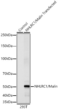 Western blot analysis of lysates from wild type (WT) and 293T cells transfected with NHLRC1/Malin using NHLRC1/Malin Rabbit mAb at 1:9000 dilution incubated overnight at 4℃.|Secondary antibody: HRP-conjugated Goat anti-Rabbit IgG (H+L) at 1:10000 dilution.|Lysates/proteins: 20 μg per lane.|Blocking buffer: 3% nonfat dry milk in TBST.|Detection: ECL Basic Kit|.Exposure time: 15s.