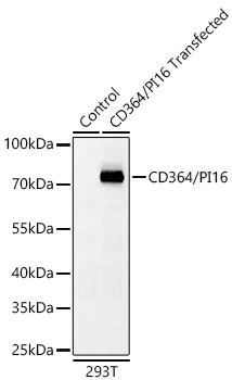 Western blot analysis of lysates from wild type (WT) and 293T cells transfected with CD364/PI16 using CD364/PI16 Rabbit mAb at 1:1000 dilution incubated overnight at 4℃.|Secondary antibody: HRP-conjugated Goat anti-Rabbit IgG (H+L) at 1:10000 dilution.|Lysates/proteins: 20 μg per lane.|Blocking buffer: 3% nonfat dry milk in TBST.|Detection: ECL Basic Kit|.Exposure time: 10s.