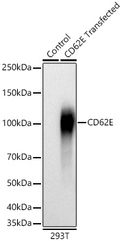 Western blot analysis of lysates from wild type (WT) and 293T cells transfected with CD62E using CD62E Rabbit mAb at 1:1000 dilution incubated overnight at 4℃.|Secondary antibody: HRP-conjugated Goat anti-Rabbit IgG (H+L) at 1:10000 dilution.|Lysates/proteins: 20 μg per lane.|Blocking buffer: 3% nonfat dry milk in TBST.|Detection: ECL Basic Kit|.Exposure time: 30s.