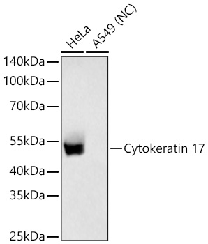 Western blot analysis of various lysates using Cytokeratin 17 Rabbit mAbat 1:25000 dilution incubated overnight at 4℃.|Secondary antibody: HRP-conjugated Goat anti-Rabbit IgG (H+L) at 1:10000 dilution.|Lysates/proteins: 25 μg per lane.|Blocking buffer: 3% nonfat dry milk in TBST.|Detection: ECL Basic Kit.|Negative control (NC): A549|Exposure time: 5s.