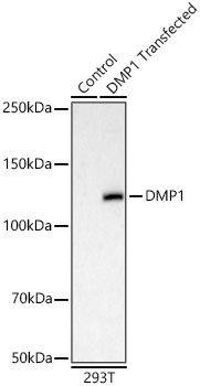 Western blot analysis of lysates from wild type (WT) and 293T cells transfected with DMP1 using DMP1 Rabbit mAb at 1:17000 dilution incubated overnight at 4℃.|Secondary antibody: HRP-conjugated Goat anti-Rabbit IgG (H+L) at 1:10000 dilution.|Lysates/proteins: 20 μg per lane.|Blocking buffer: 3% nonfat dry milk in TBST.|Detection: ECL Basic Kit|.Exposure time: 60s.