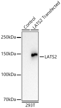 Western blot analysis of lysates from wild type (WT) and  cells transfected with LATS2 using LATS2 Rabbit mAb at 1:5000 dilution incubated overnight at 4℃.|Secondary antibody: HRP-conjugated Goat anti-Rabbit IgG (H+L) at 1:10000 dilution.|Lysates/proteins: 20 μg per lane.|Blocking buffer: 3% nonfat dry milk in TBST.|Detection: ECL Basic Kit|.Exposure time: 5s.