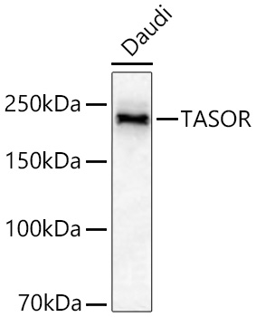Western blot analysis of lysates from Daudi cells using TASOR Rabbit mAb at 1:6000 dilution incubated overnight at 4℃.|Secondary antibody: HRP-conjugated Goat anti-Rabbit IgG (H+L) at 1:10000 dilution.|Lysates/proteins: 25 μg per lane.|Blocking buffer: 3% nonfat dry milk in TBST.|Detection: ECL Basic Kit.|Exposure time: 45s.